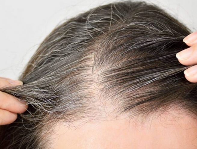 ¿El estrés produce canas?