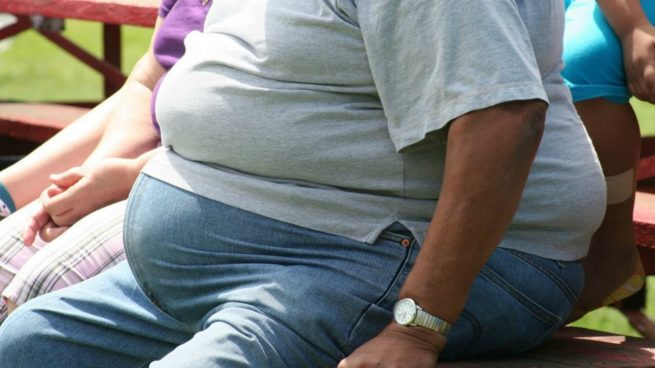 ¿La obesidad reduce la esperanza de vida?